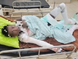 Remaja 18 Tahun Asal Lamtim Bakar Diri Sampai Tewas Usai Dibully Miskin