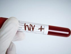 Terpapar HIV/AIDS, 6 Orang Anak di Cianjur Meninggal Dunia