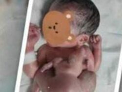 Seorang Bayi Lahir dengan Kondisi 4 Kaki dan 4 Tangan, Pertanda Apa??